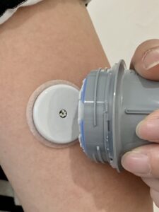 【最新】指を刺さずに24時間血糖管理!──FreeStyleリブレ2の導入メリットのアイキャッチ画像